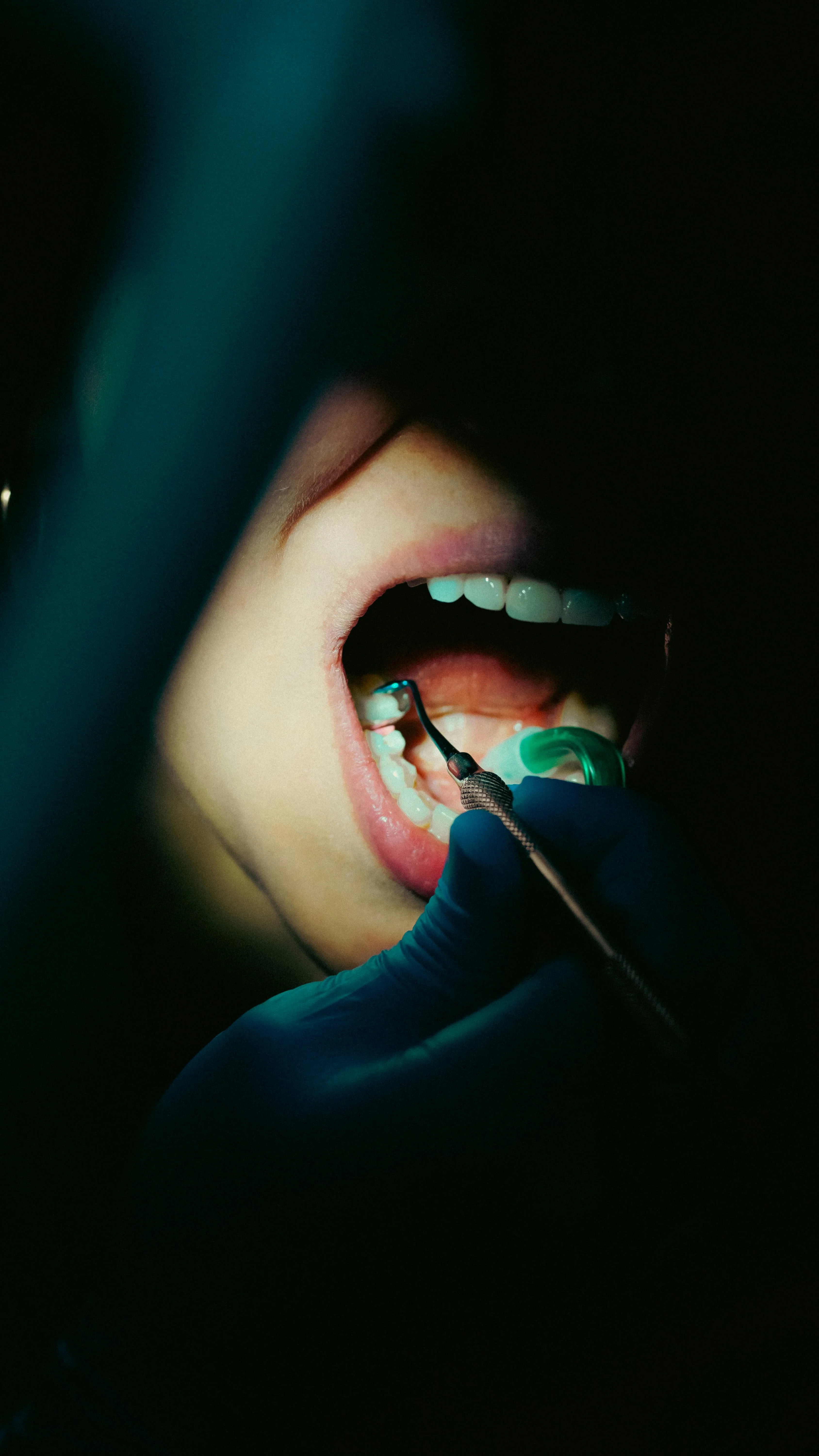 Como prevenir la caries con habitos sencillos